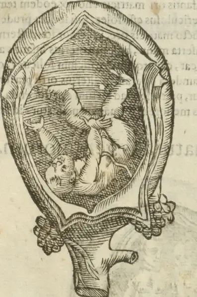 Illustration from page 61